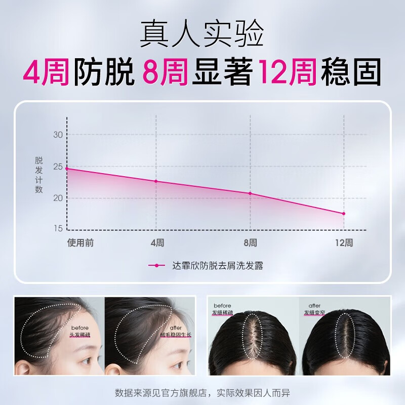 达霏欣达霏欣防脱洗发水侧柏叶清爽不油蓬松改善细软塌发防断洗发洗头膏 防脱 300ml*2瓶