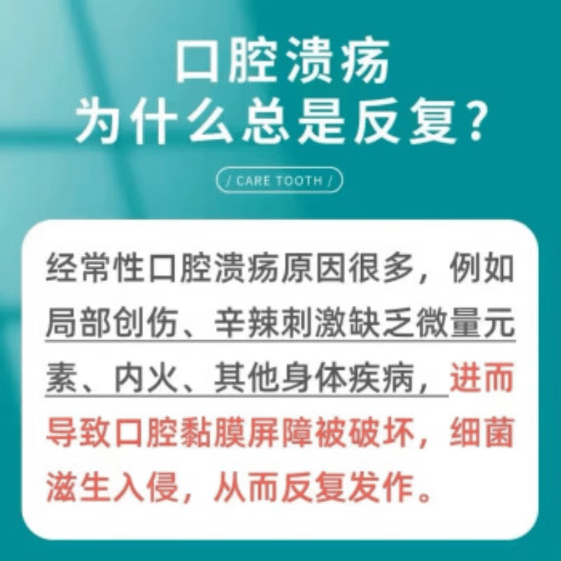 岩井晟弘制药日本口腔溃疡特专用的药喷剂凝胶嘴巴反复溃疡上火起泡口舌生疮 特价单盒装【特效喷剂】