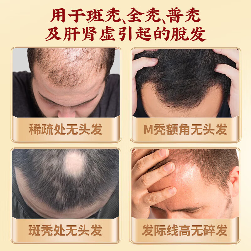 [仁和]固肾生发丸 2.5g*27袋 10盒装 斑秃 全秃 普秃及肝肾虚引起的脱发严重男女专用掉头发的药养血 2.5g*27袋