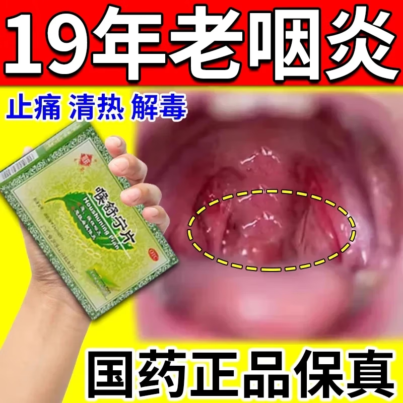宁片耳鼻喉用药【成人专用 1盒本品 冬凌草片【根据说明书治】难除根