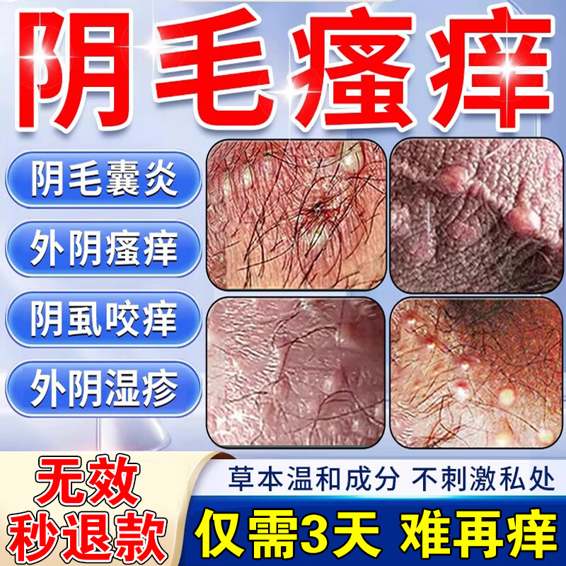 修正男人下体私处瘙痒 阴部瘙痒私处止痒 杀菌阴囊湿疹长疙瘩毛囊炎