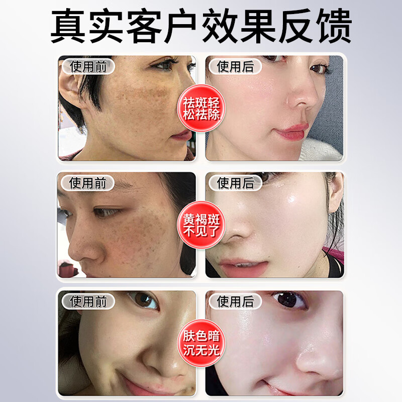 百灵鸟烟酰胺原液美白精华美白淡斑去斑淡化黑色素维生素b3烟酰胺男女士