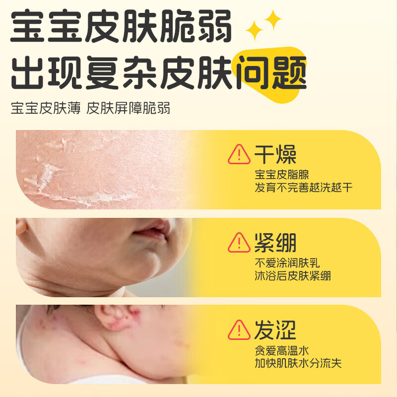袋鼠杰克凡士林金盏花儿童身体乳清爽润肤干燥止痒保湿滋润宝宝婴儿润肤乳 【滋润肌肤 改善干皮】身体乳*1瓶