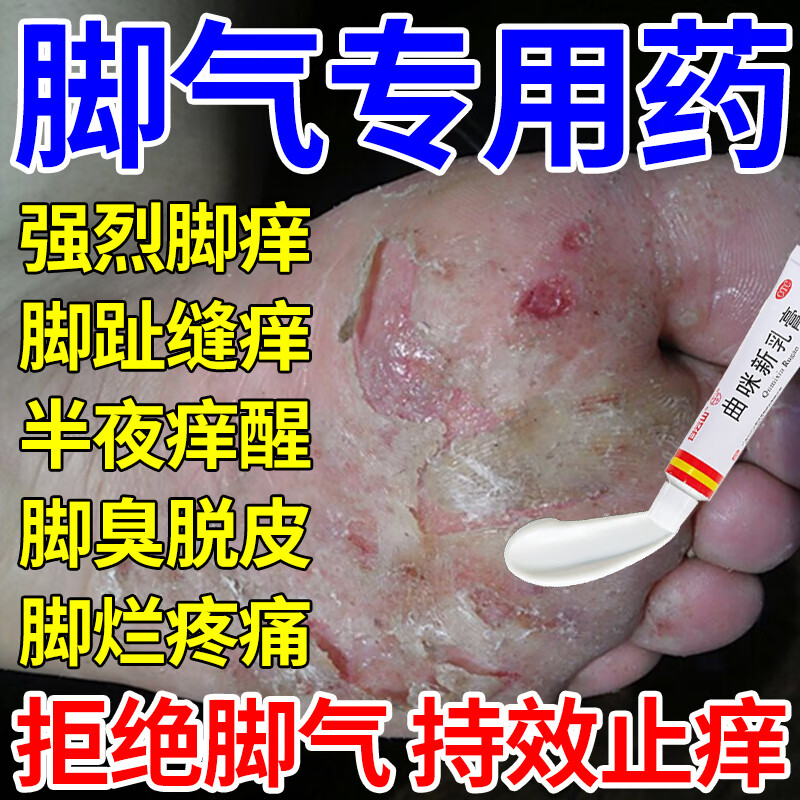 治脚气的特药脚气药止痒脱皮烂脚丫真菌感染止痒效脚趾缝痒脚烂疼痛