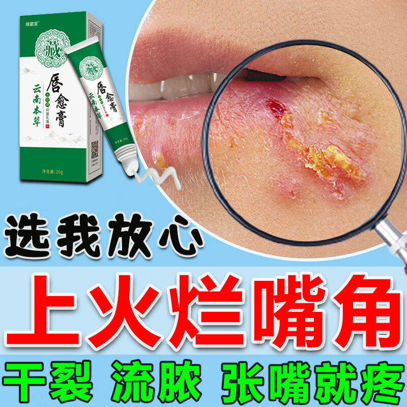 三草油唇膏唇炎医用官方店唇膏嘴巴红肿嘴唇上长疱疹干裂起皮起水泡红