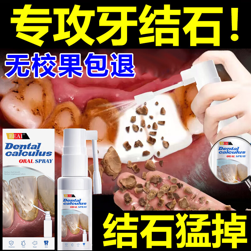 BEAI牙结石型口腔冲洗器喷雾牙齿膏去味口臭去黄溶解去渍牙石速效35ml