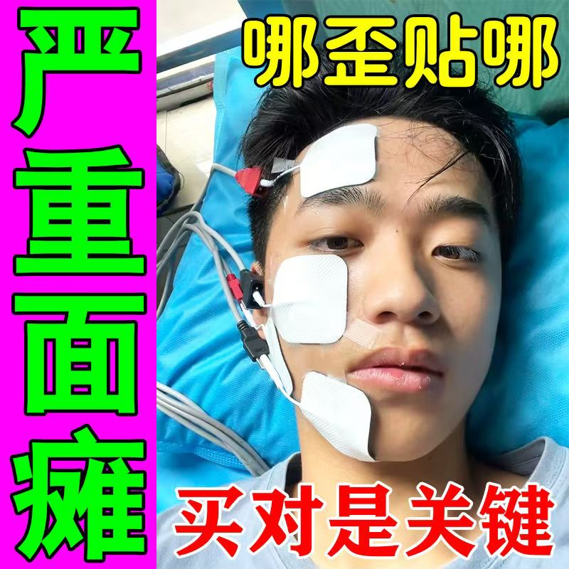 面瘫特傚效药专用康复贴膏后遗症口眼联动面瘫牵正贴面肌痉挛 3盒【80