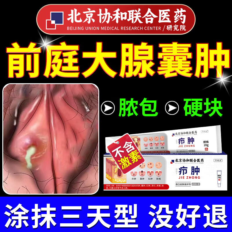 前庭大腺囊肿巴氏囊肿疼痛辅助治疗外阴疖肿拔毒有疙瘩脓包外阴巴氏腺