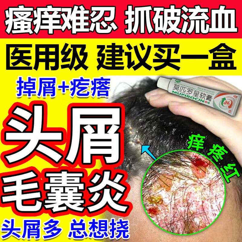 头皮屑多瘙痒头部毛囊炎抗菌药膏 治头上脓包疙瘩的药膏 一盒装【革兰