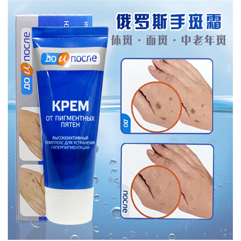ycj去i除手上老年斑去手上老年斑手部手背专用俄罗斯kpem护手霜祛i除