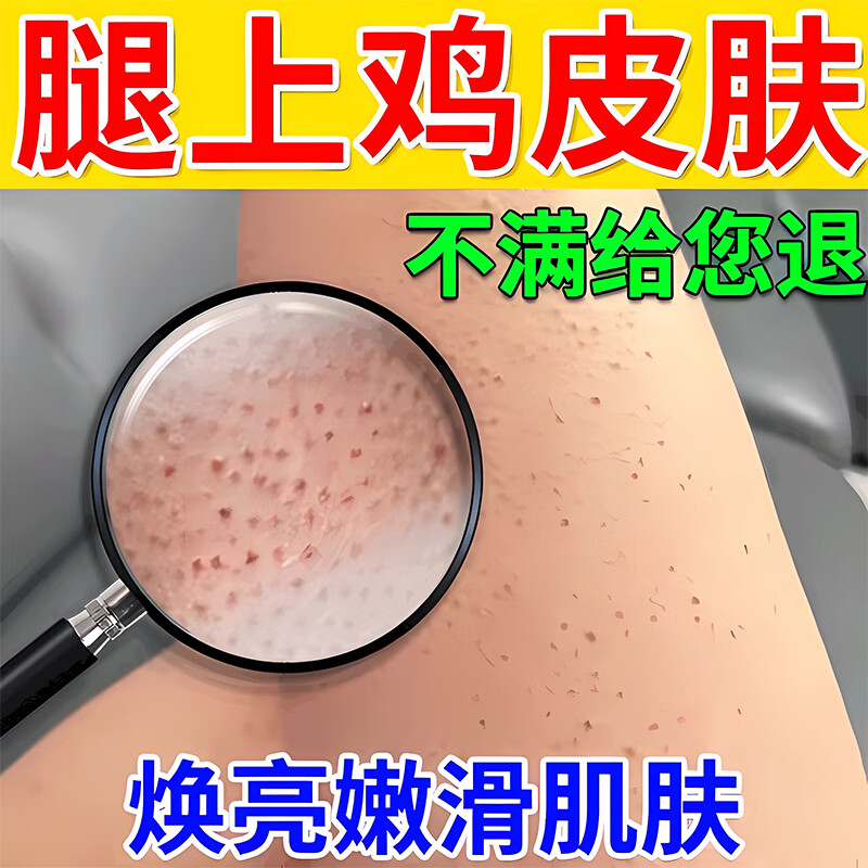 鸡皮肤疙瘩毛囊角化症专用膏药去鸡皮肤毛囊角质疙瘩大腿 手臂去除