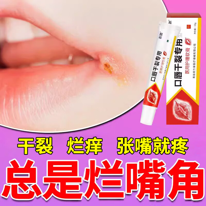 医用级口角炎药膏儿童嘴巴上火起泡烂嘴角开裂干燥起皮痒润唇修护膏