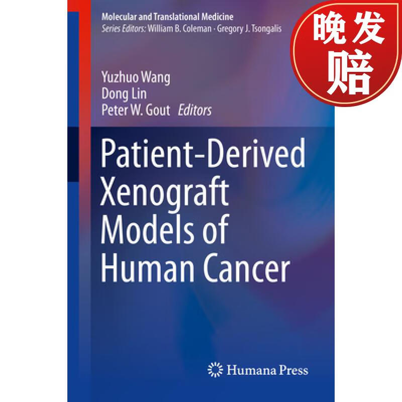 【4周达】patient-derived xenograft models of human cancer