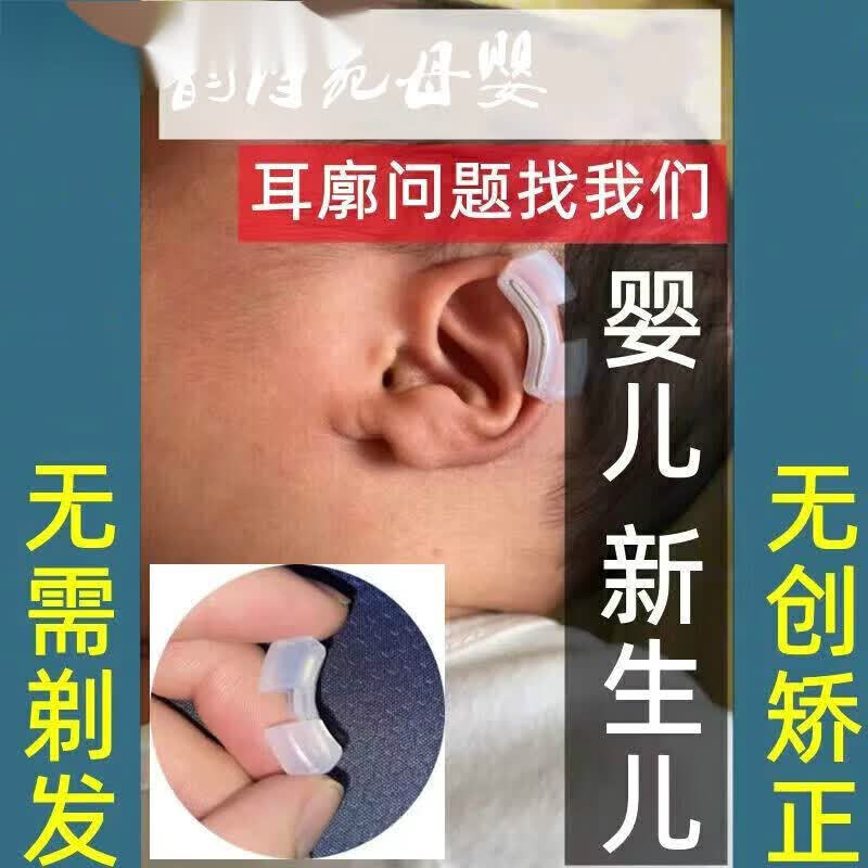 通用耳朵器ukepoe婴儿耳朵矫形器内置小儿贴耳廓贴纠正塑 b款右耳矫型