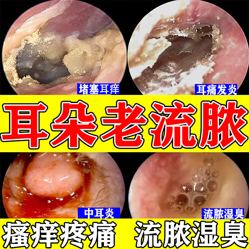 耳朵发炎流脓耳朵疼痛炎耳朵消肿炎药 耳道真菌感染引起中耳炎专心