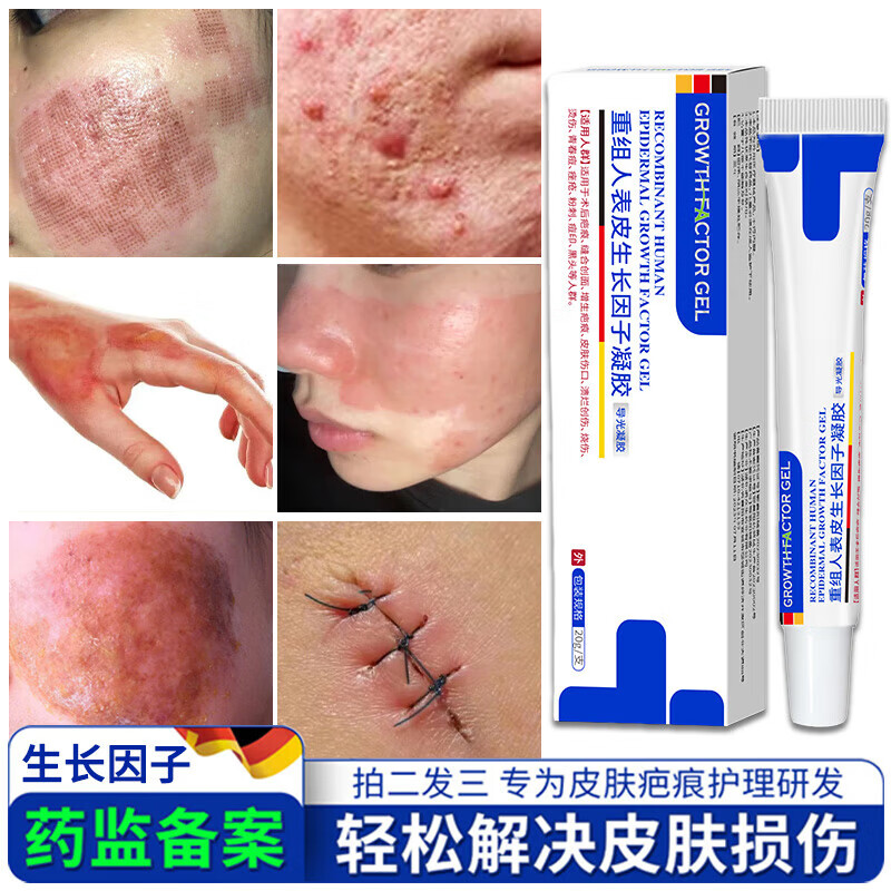 药房同款  官正方品重组人表皮生长因子凝胶疤痕人源化胶原蛋白修护