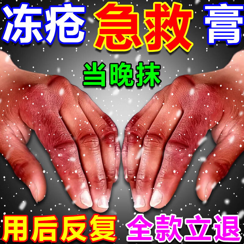 油特效正品耳朵防裂成人儿童手足消肿修复 单盒【多盒修复效果更佳】