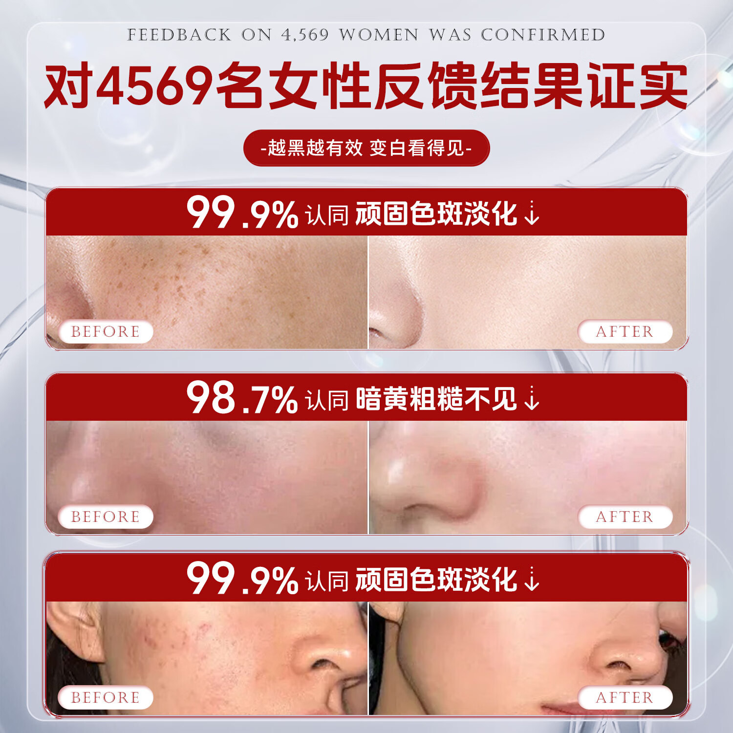 达里博士  DR.DARRY氨甲环酸精华高浓度液传明酸精华非医用去除闭口淡化色素湿敷液