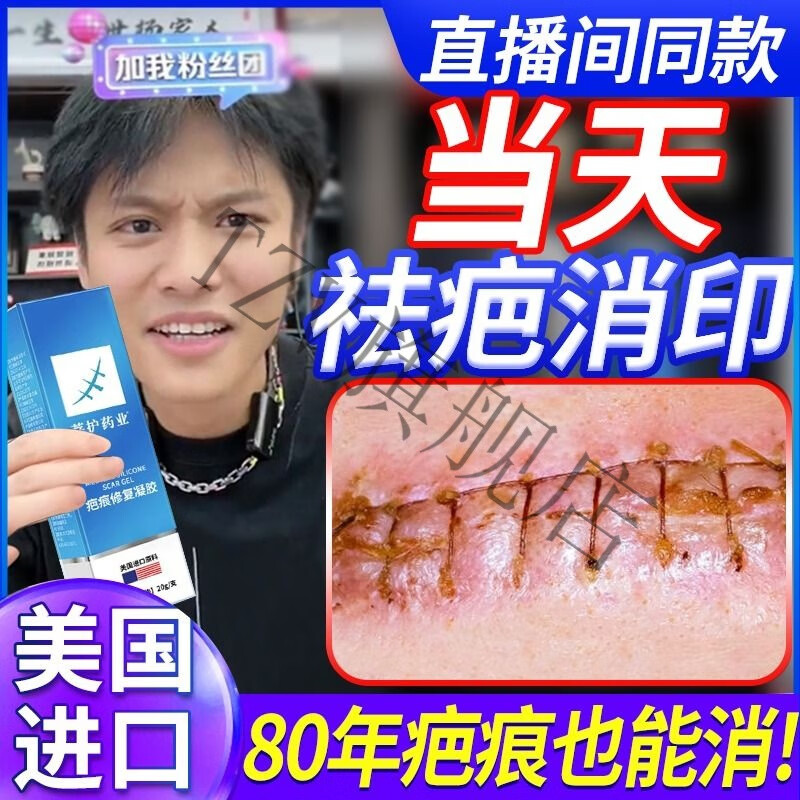 熏姿颜奥朗威疤痕贴疤克膏官方旗舰店疤痕修复除i疤膏增生凸起 【一支