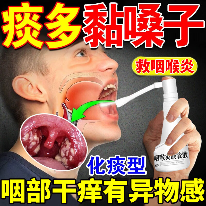 有异物感咽喉肿痛根咽炎专用喷雾药剂片口腔清洁冲洗器 一盒 轻度症状