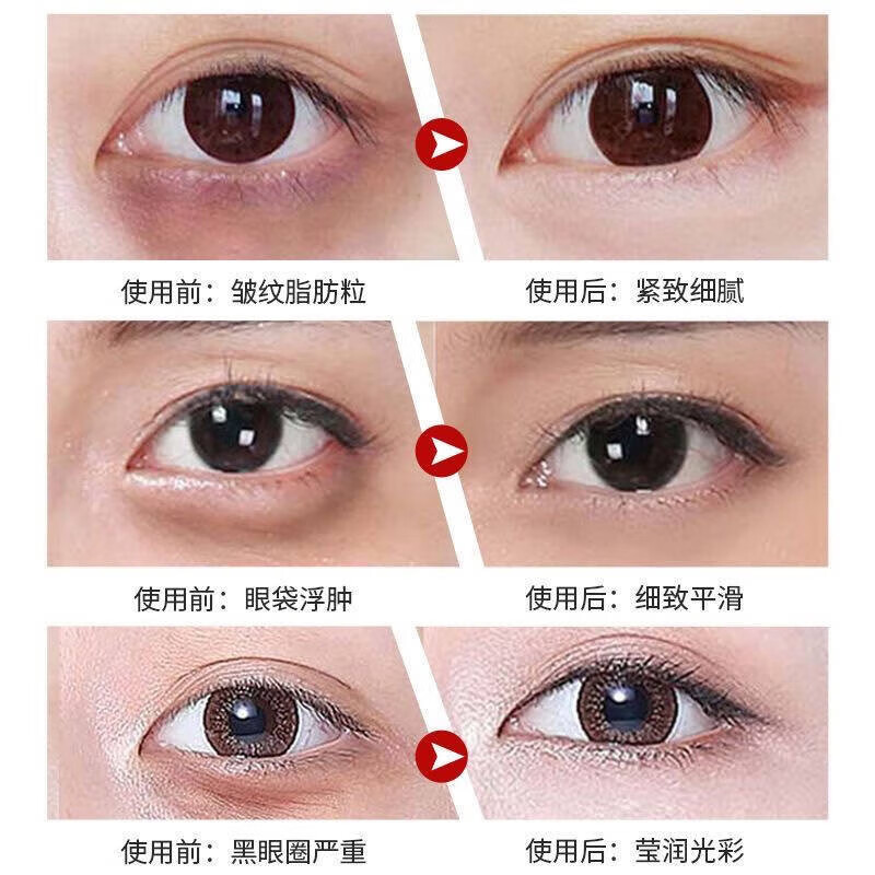 国药精养类蛇毒多肽眼霜黑眼圈眼袋淡化细纹保湿男女士眼霜 50g/1瓶 国药精养眼霜3瓶