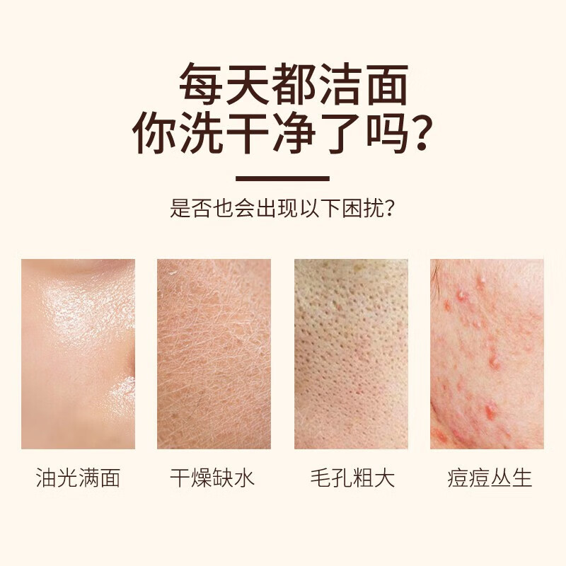 老中医痘清洗面奶 弱酸性洁面乳 减少毛孔阻塞并缓减痘痘生长清爽不紧绷 痘清洗面奶120g