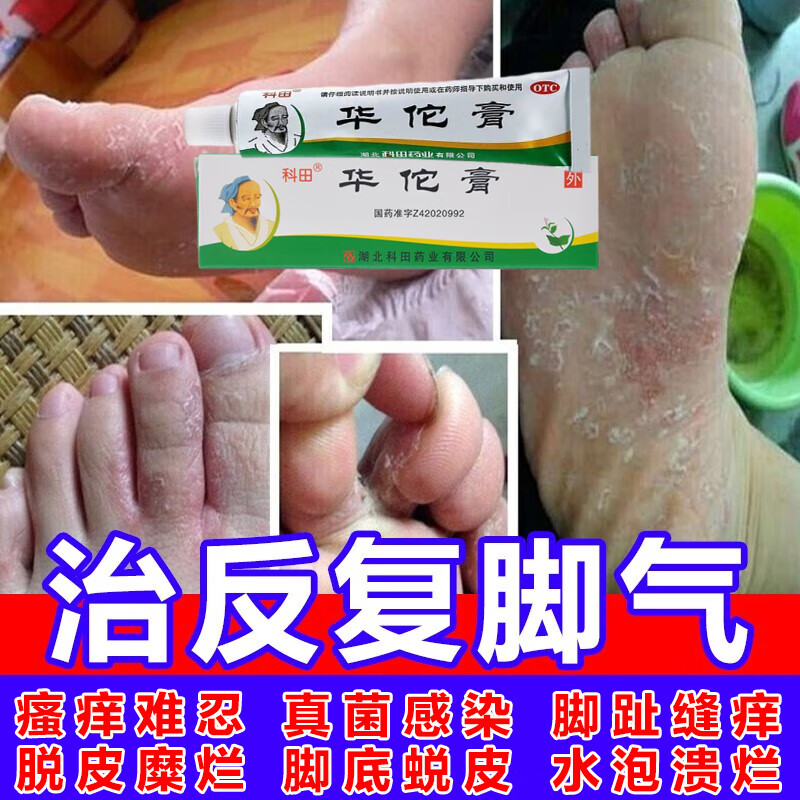 真菌感染脚气药软膏杀菌 抗菌  止痒脱皮烂脚丫 水泡糜烂 手足癣体