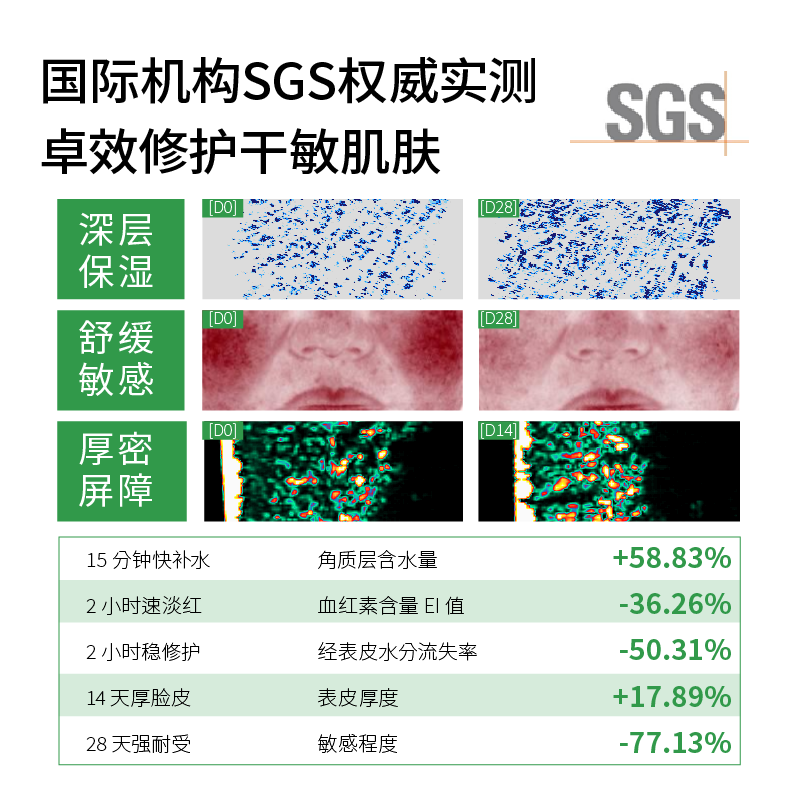 基理基底膜ECM修护霜干敏肌舒缓泛红屏障受损纤连蛋白面霜抗皱油敏霜 【干敏套装】洁面+水+修护霜50g