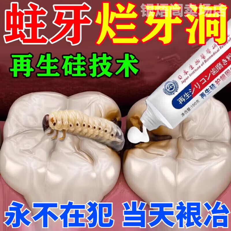 蛀牙牙洞清理牙虫的药再生硅护龈固齿护理牙膏防蛀牙清洁京正品 1支