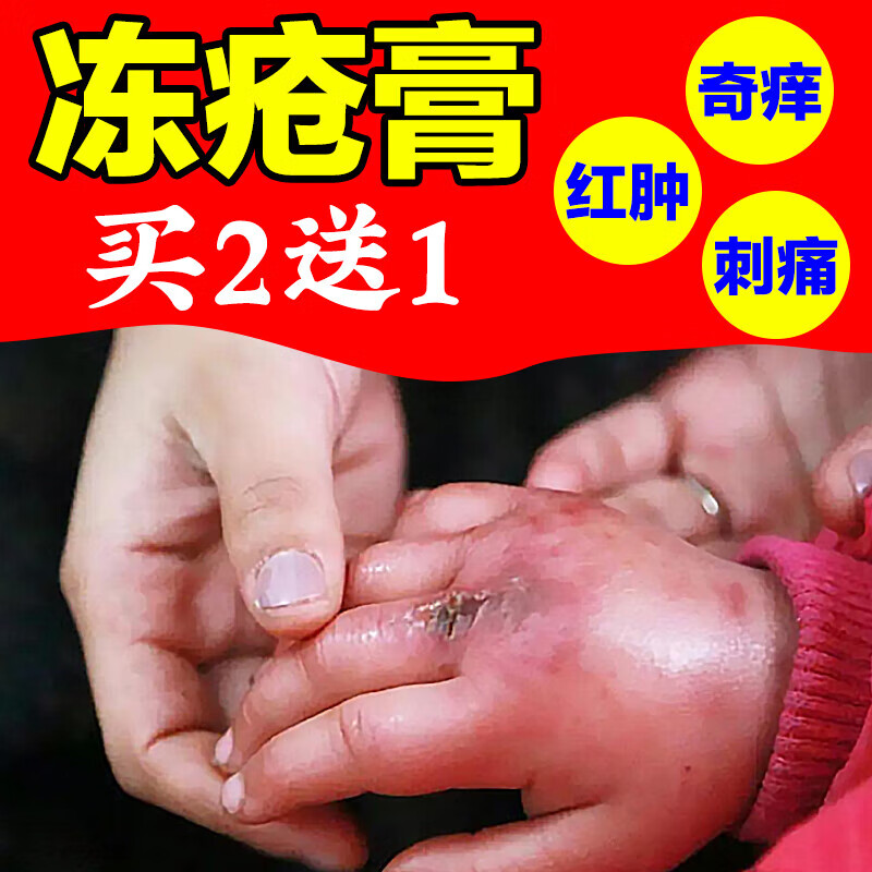 建功立业【旗舰优选】冻疮膏手脚耳朵非止i痒冻伤膏秋冬成人儿童手足