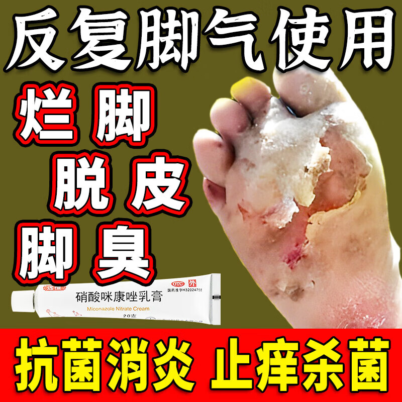 烂脚丫药脱皮糜烂脚趾缝烂痒专痒用药 脚气药止很痒脱皮烂脚丫真菌