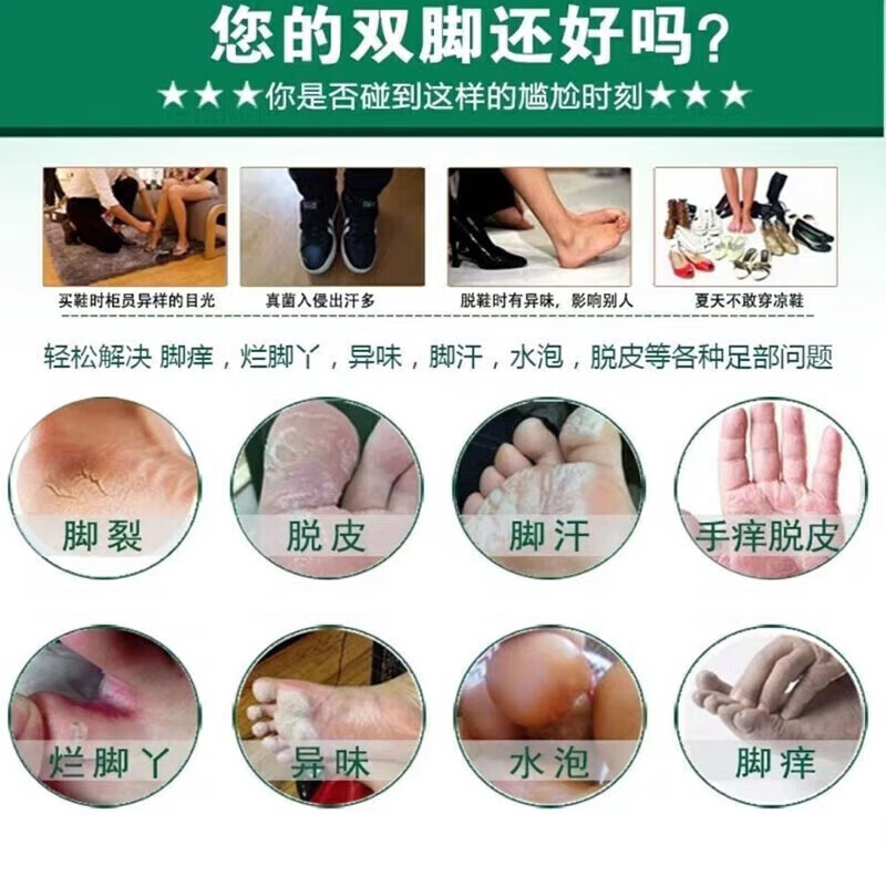 [韩都]克霉唑乳膏 脚气药止痒脱皮烂脚丫真菌感染根烂脚丫药脚趾缝烂痒专用的特新效期药治疗溃烂皮肤用药 1%*10g 1盒装 【医用脚气药】