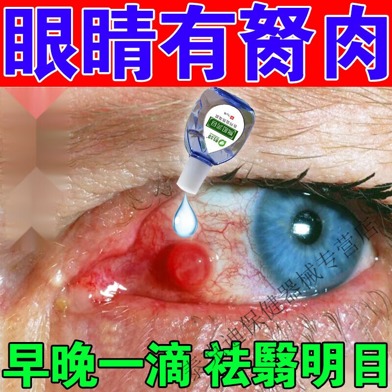 眼睛胬肉红血丝视力模糊翼状胬肉眼干眼红异物感熊i胆明 单盒体验装