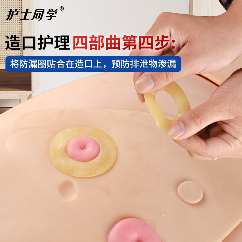 护士同学二件式卡扣式造口袋魔术贴带活性碳过滤片粘扣款造瘘袋10386同款 【护肤四宝】造口护理四件套