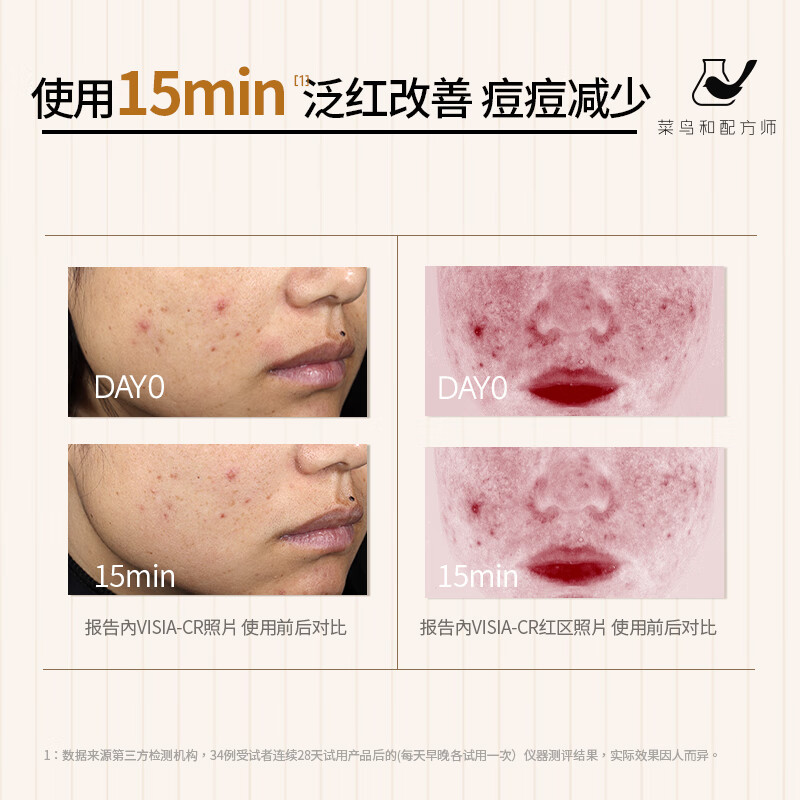 菜鸟和配方师姜黄素祛痘精华液 速褪红舒缓修护祛青春痘熬夜姨妈痘 三代30ml*2瓶