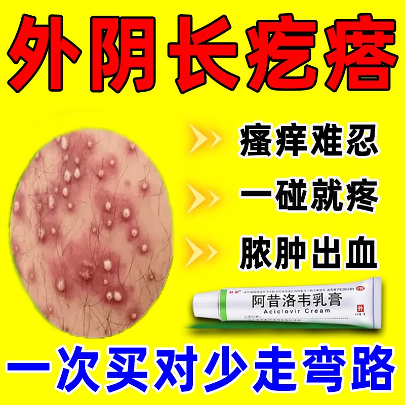 外阴长疙瘩女人私处痒专用药治女性外阴有疙瘩长痘痘外阴瘙痒红肿水泡