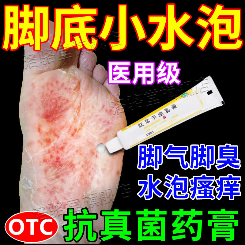 脚底起小水泡又痒又脱皮治脚气药止痒脱皮烂脚丫真菌感染止痒脚臭联苯