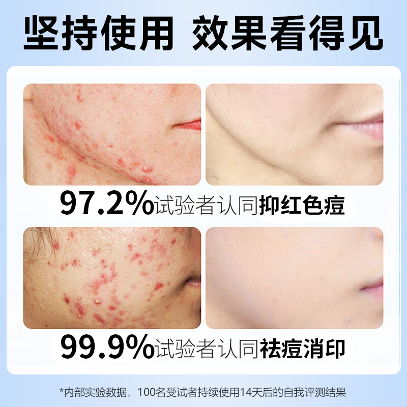 H18水杨酸洗面奶男女士控油祛痘去黑头收缩毛孔淡化痘印深层清洁面乳