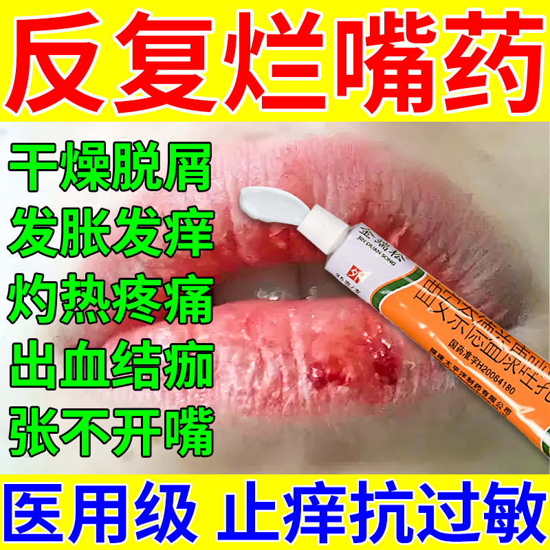 唇炎口角炎专用药】慢性唇炎嘴唇干裂脱皮嘴巴红肿瘙痒出血结痂张不开