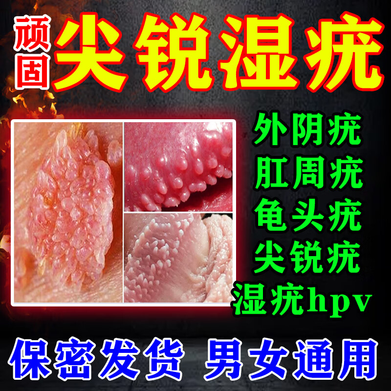 去除男性女性私处感染菜花状鸡冠状丘疹状珠疹冠状沟肛周效通用特药膏