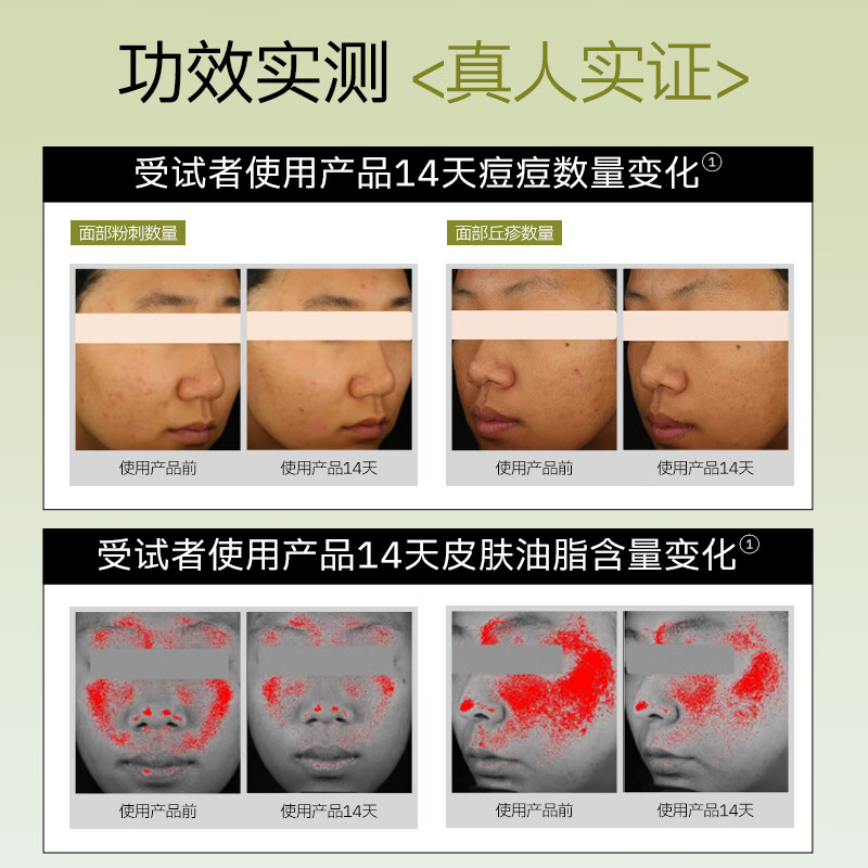 瑷尔博士面膜清肌面膜保湿舒缓控油祛痘护肤品生日礼物送女友 【低至5.23/片】清肌面膜到手17片