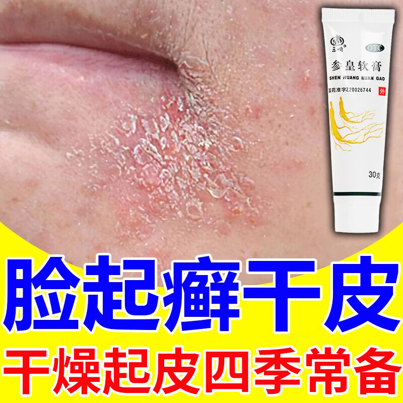 面部四季皮肤干燥脱皮过敏油腻止痒养血润燥参皇软膏 1盒装【脸干燥起
