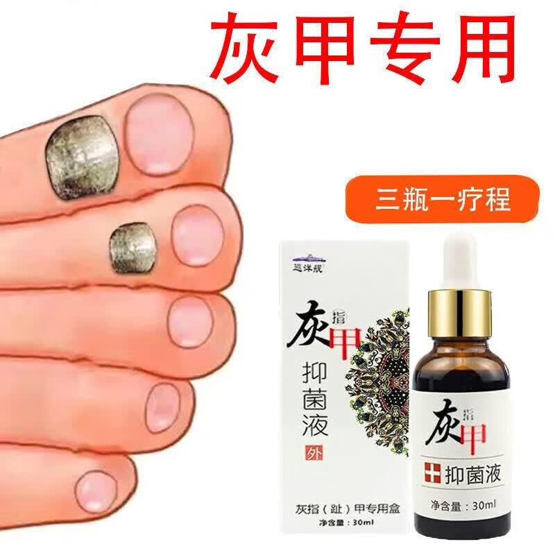 【大药房直发】巡洋舰灰指甲去除增厚严重甲沟炎抑菌甲脱甲膏 1盒