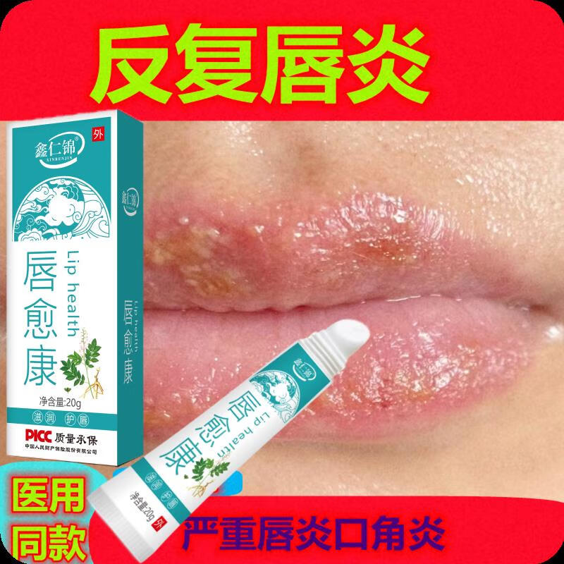 三草油唇膏唇炎医用唇膏嘴巴红肿嘴唇上长疱疹干裂起皮起水泡红痒脱皮