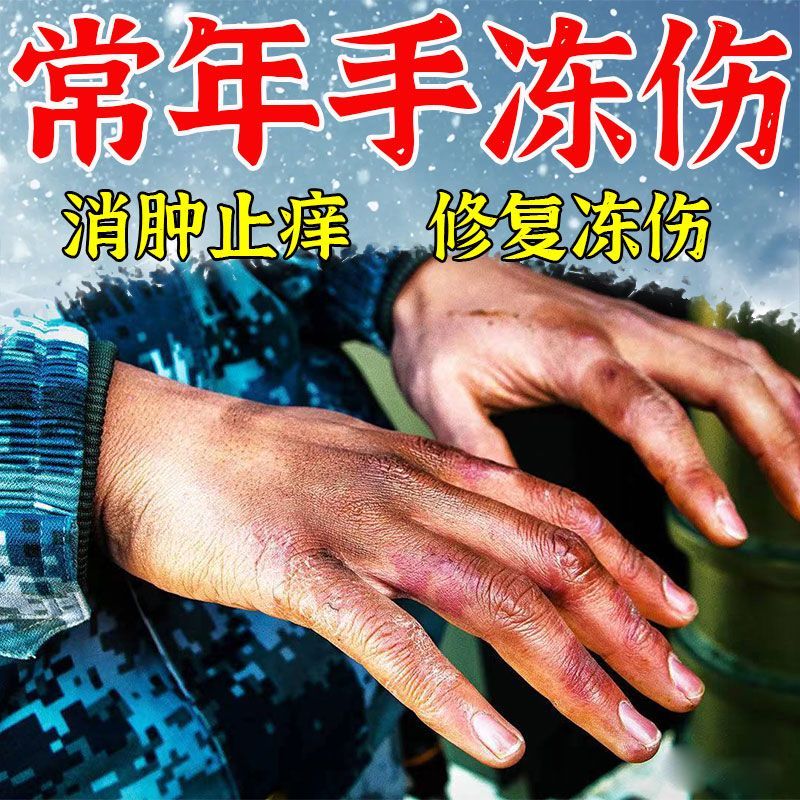 冻疮膏20g止痒冻伤药膏冻手膏冻疮膏专用药儿童成人耳朵脸部防冻消肿