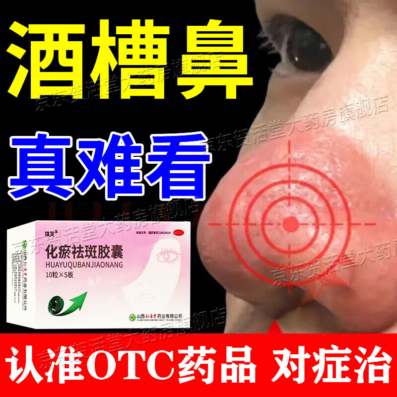 酒糟鼻专用药草莓鼻修复玫瑰痤疮红鼻子红肿长痘脓包红血丝鼻子两边