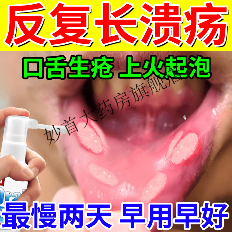 嘴巴上火起泡烂口腔溃疡特傚效药喷剂口腔溃疡专用的药 嘴巴反复溃疡