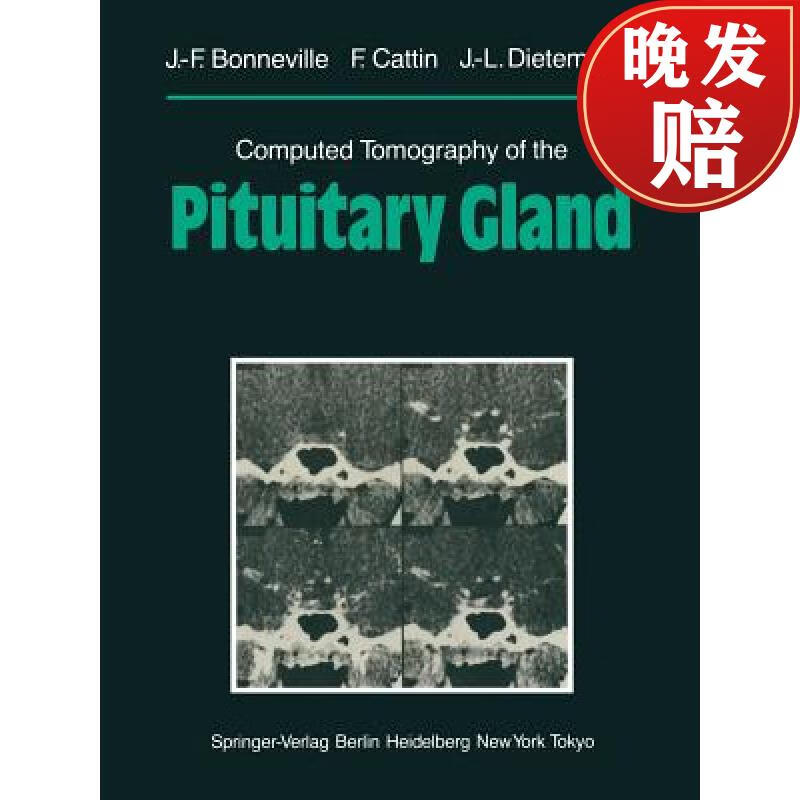 【4周达】computed tomography of the pituitary gland: with a