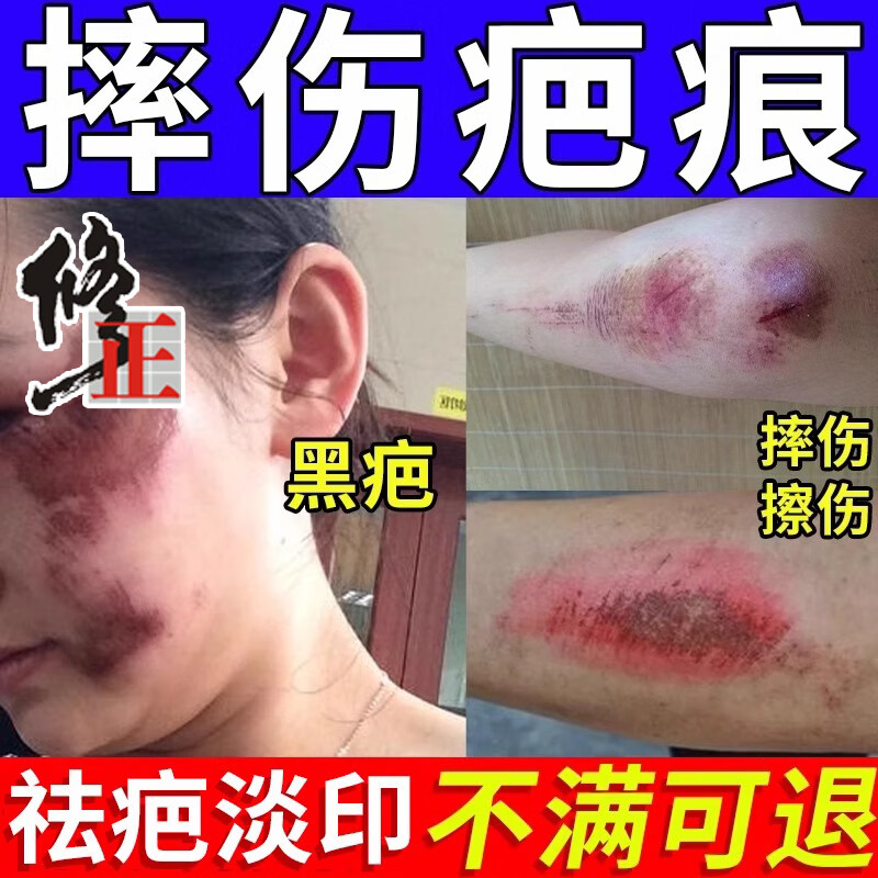 修正疤痕修复除疤膏剖腹产疤痕淡去摔伤烫伤刮伤疤痕增生凸起去除疙瘩