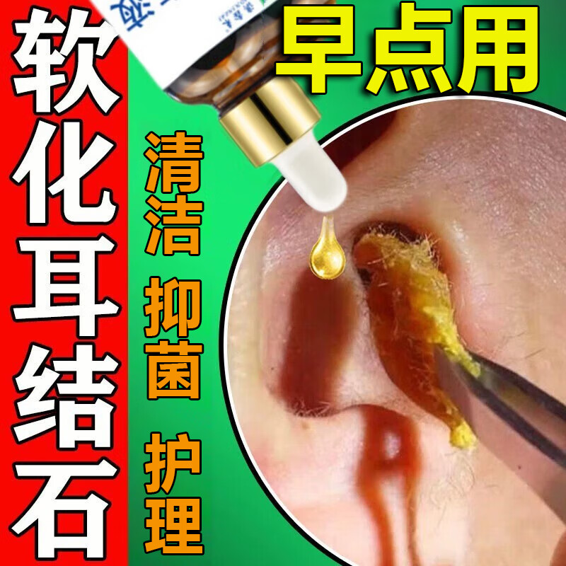 软化耳屎的滴耳液儿童耳结石快速软化水耳痒耳痛耳道清理耳朵专用 一